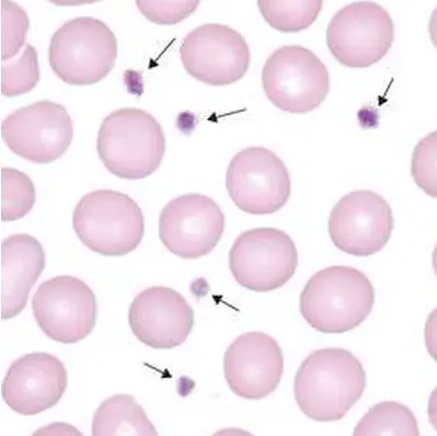 microscopic examination of platelets