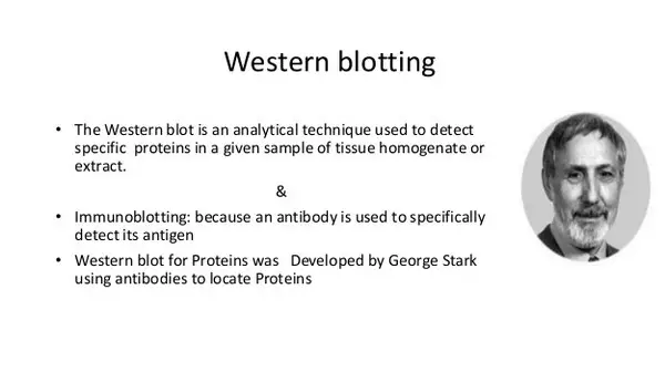 George Stark and his group were the ones responsible for the development of western blot