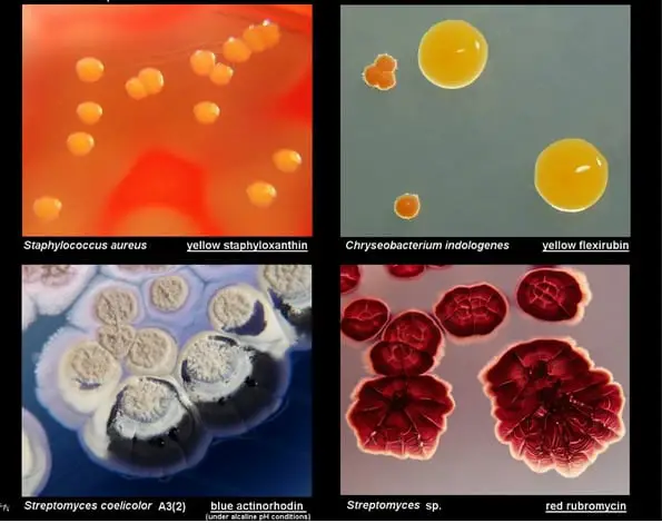 Images of the bacterial colony with a varying degree of pigmentation
