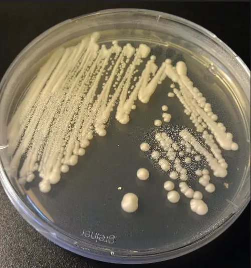 colony of yeast on the agar plate