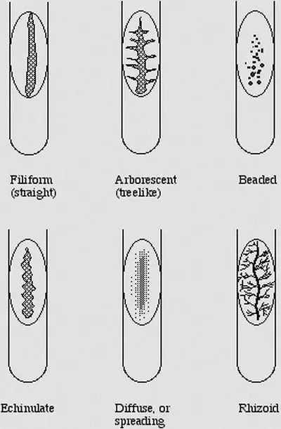 image shows the typical characteristics of the bacterial colony on agar slants