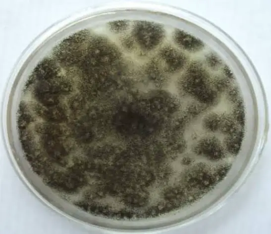 Aspergillus growth on potato dextrose agar picture
