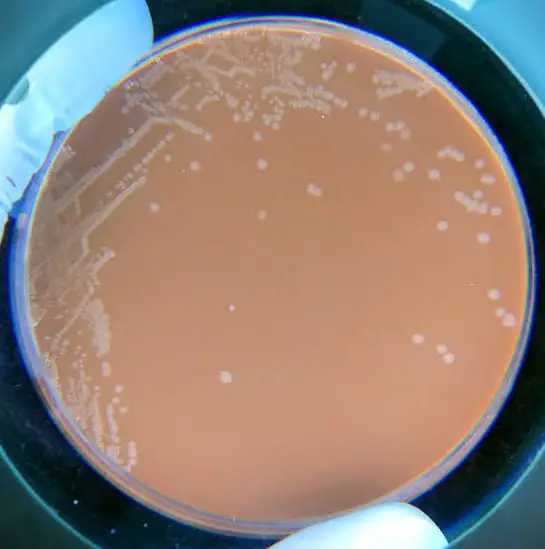 H. influenza colonies on a chocolate agar