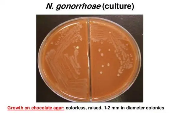 growth of N. gonorrhoeae on chocolate agar