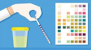 Image illustrating how to perform a ketones in urine test