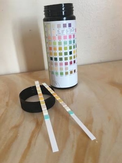 Urinalysis Urine Testing Types Process Results Interpretation Reference Charts 1302