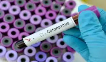 Novel-coronavirus-specimen-should-be-collected-using-strict-collection-measures