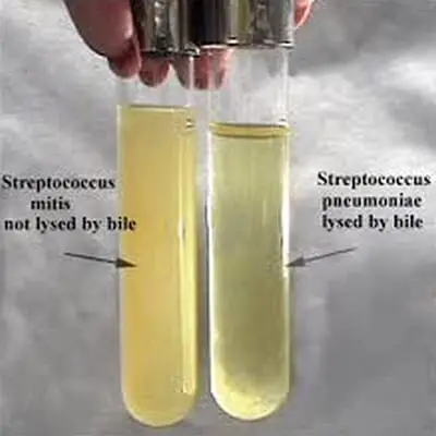 ONPG test of Streptococcus bacteria as seen on two test tubes