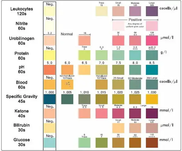 Urinalysis Chart