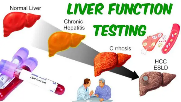 image shows different representations of the liver with corresponding diseases