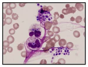 Wright's Stain - Procedure, Principle, Components, Uses And Blood Smear ...