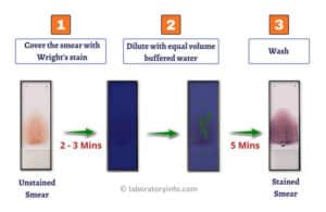 Wright's Stain - Procedure, Principle, Components, Uses And Blood Smear ...