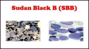 Sudan Black B Stain – Purpose, Principle, Procedure, Preparation, Protocol and Clinical importance