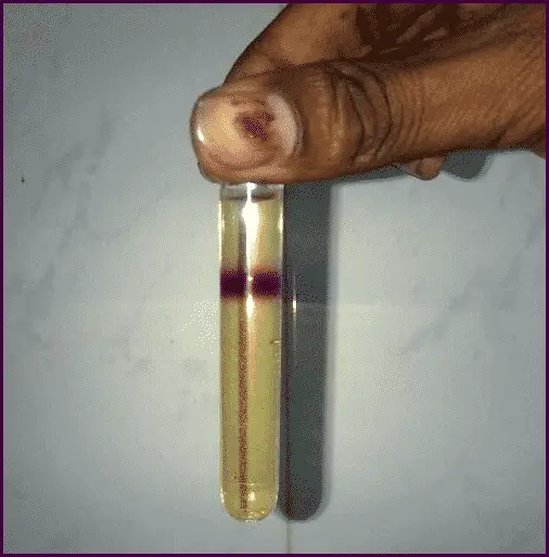 A test tube containing sample solution set for Rothera test. The presence of a purple permanganate-colored ring indicates a positive result