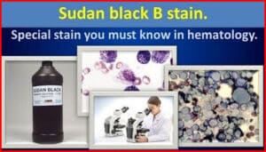 Sudan Black B Stain - Purpose, Principle, Procedure, Preparation ...