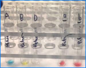 Reverse Blood Grouping (Reverse Typing) - Principle, Procedure And ...