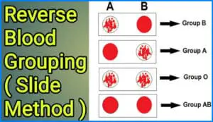 Reverse Blood Grouping (Reverse typing) – Principle, Procedure and Interpretation