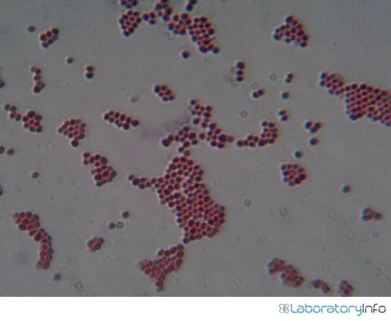 Microscopic view of the gram negative image