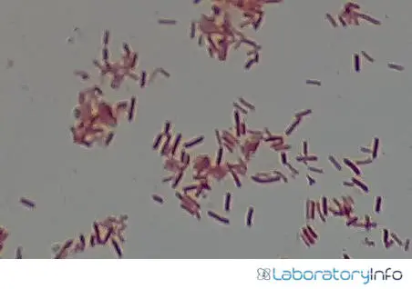 Microscopic view of the gram negative rods image