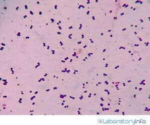 Gram-Positive Bacteria: Characteristics, List, Cell wall composition ...