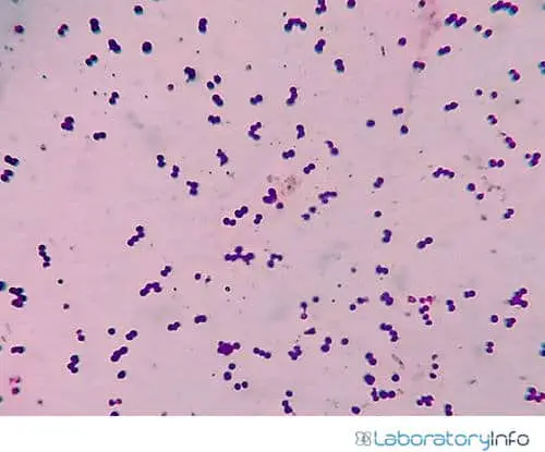 microscopic view of the grams-stain positive cocci image