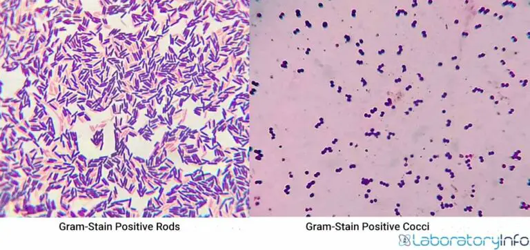 Gram Positive Bacteria Characteristics List Cell Wall Composition Classification And