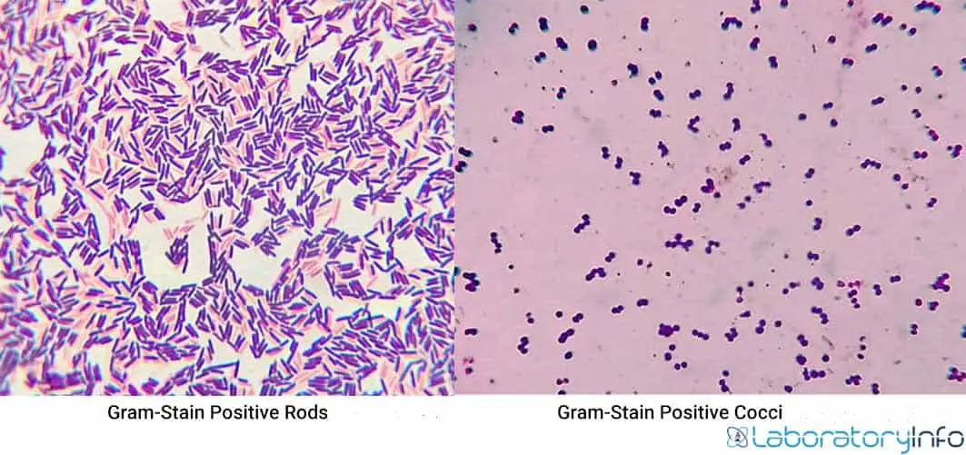 microscopic view of the grams-stain positive rods and gram stain positive cocci image