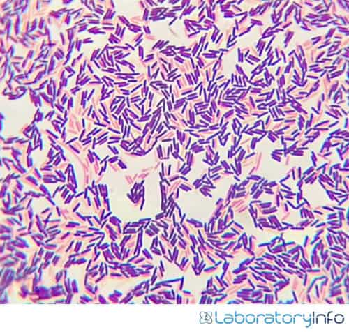 Gram-Positive Bacteria: Characteristics, List, Cell wall composition ...