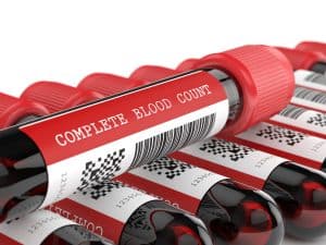 Complete Blood Count (CBC) Abbreviations